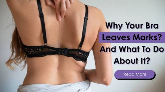 Why Your Bra Leaves Marks? — And What To Do About It?